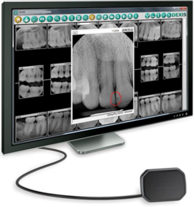 Digital x-rays