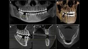 cbct image.jpg
