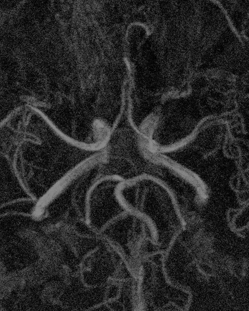 hh+gluggi-sonuskr%C3%B6lt-1-4.jpg