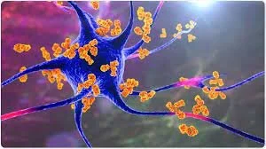 Auto-immunité : savez-vous si vous allez vous en sortir?