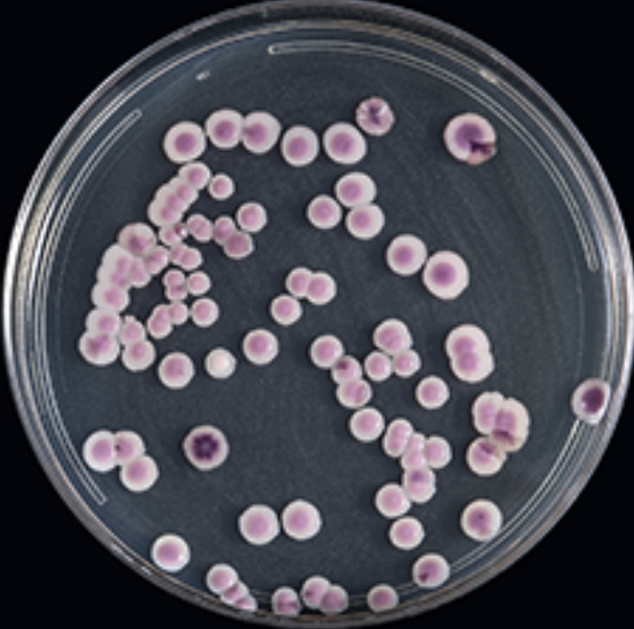 Candida auris : une nouvelle menace nosocomiale majeure