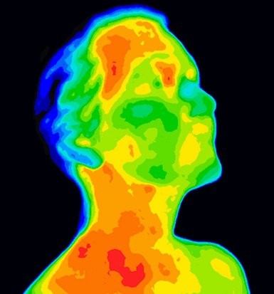 Sinuses and Lymphatics