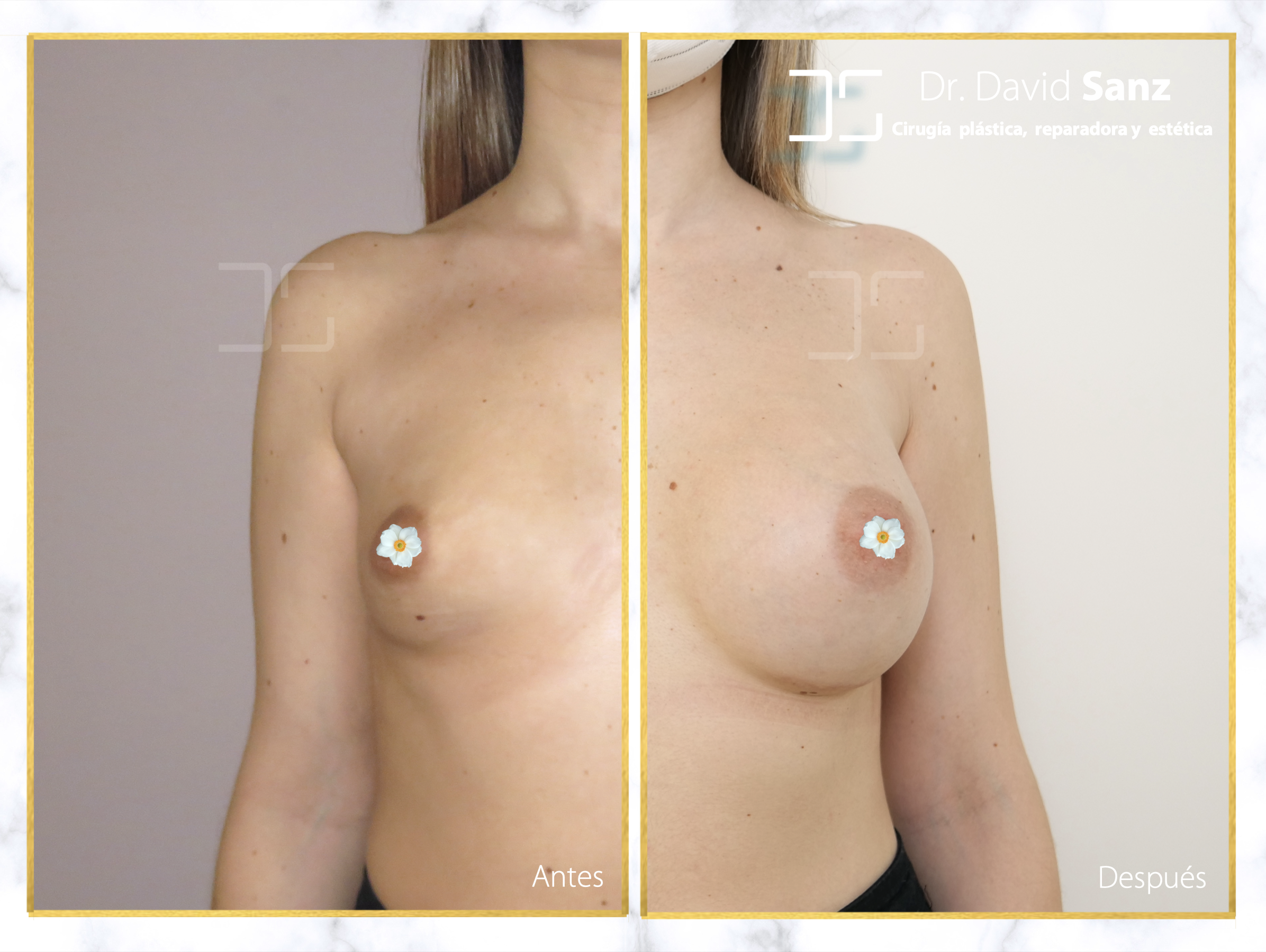 Mamas vacías — Dr. David SANZ