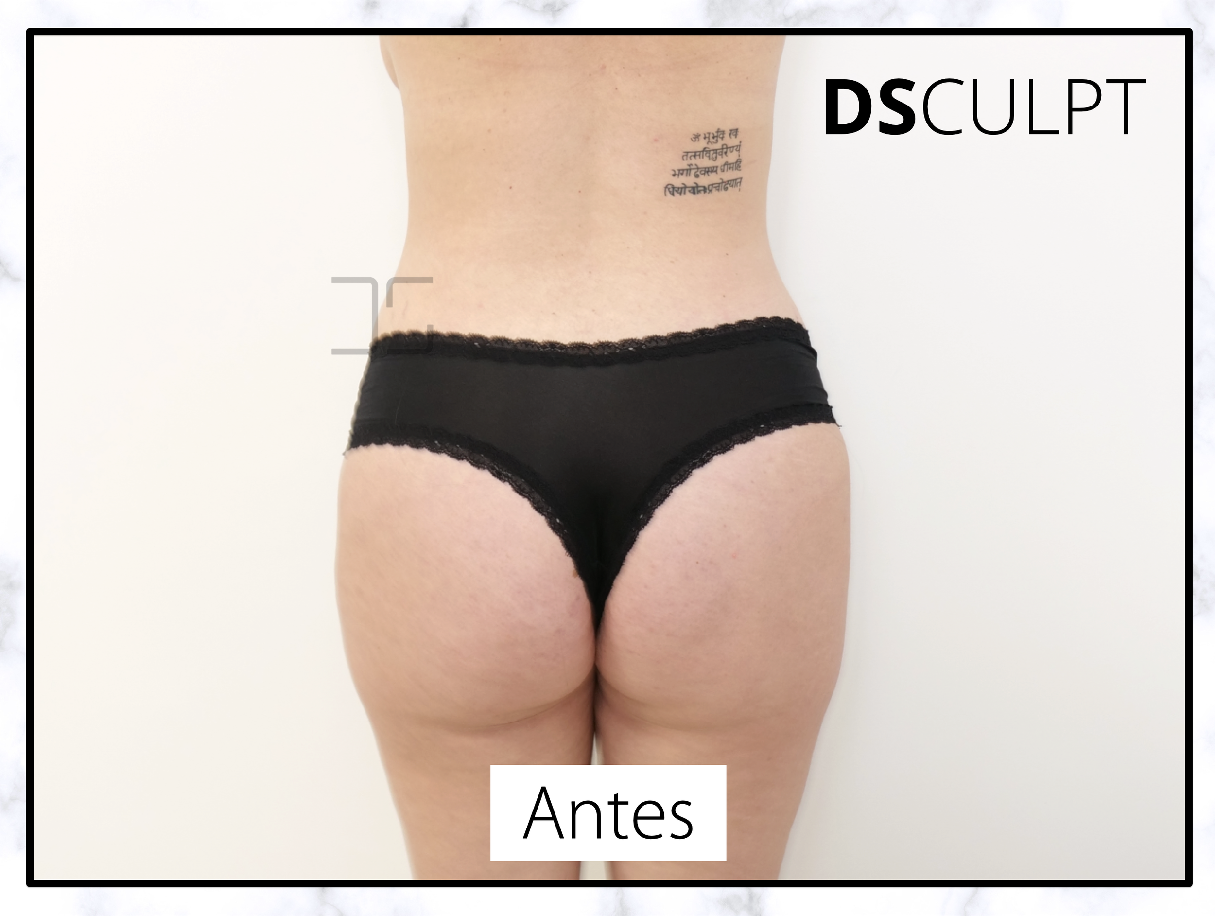 gluteos barcelona antes.png