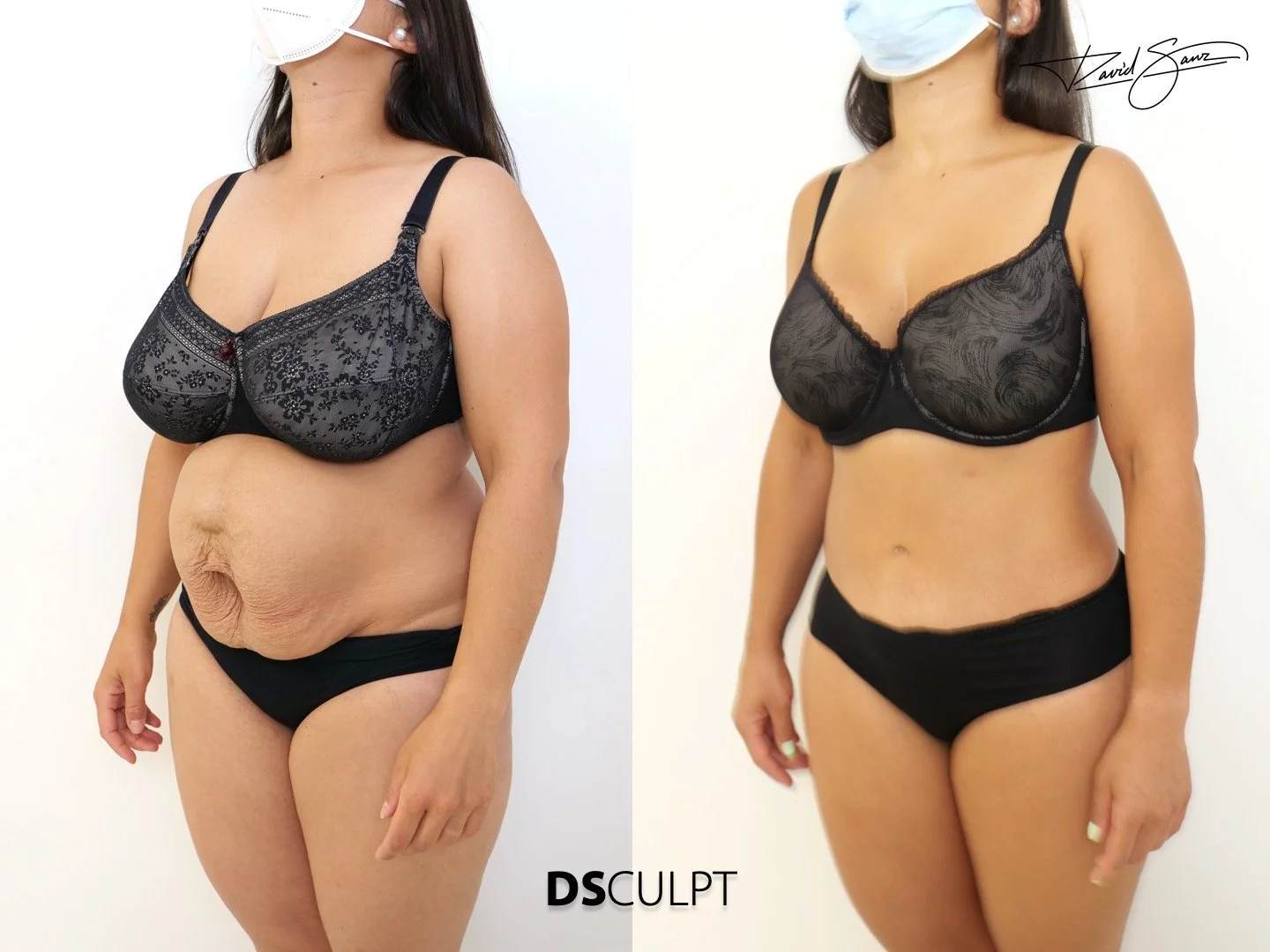 cirujano-plastico-especialista-reparacion-abdominal-barcelona.jpeg