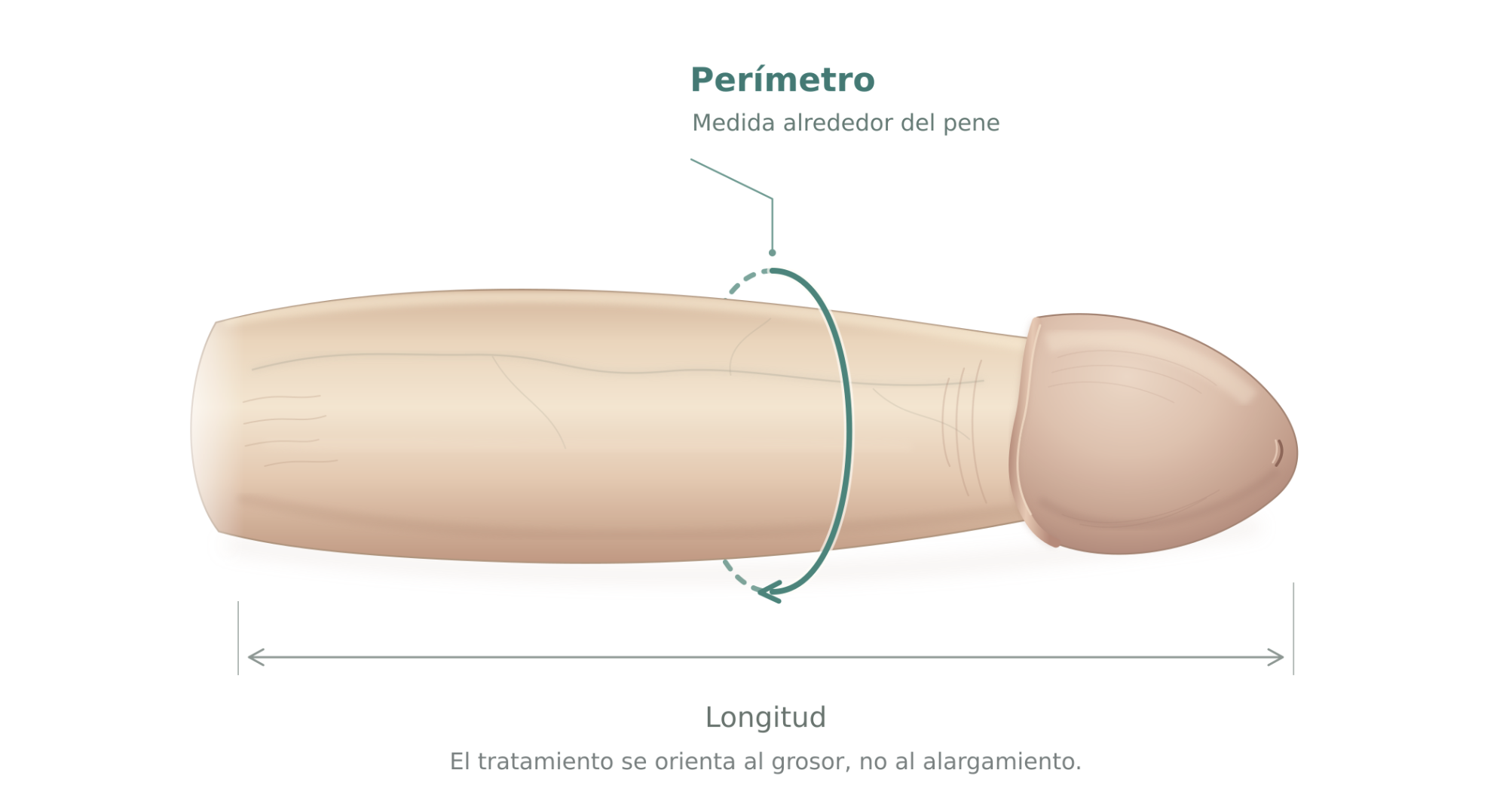 Tratamiento de engrosamiento de pene: fotografías de antes y después.