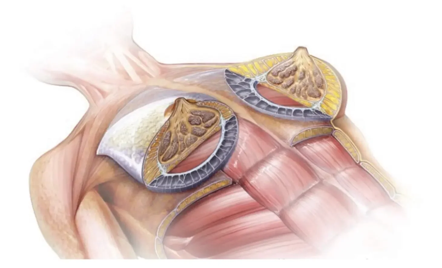 Ilustración anatómica de la conservación de los ligamentos de Cooper con la técnica Preservé