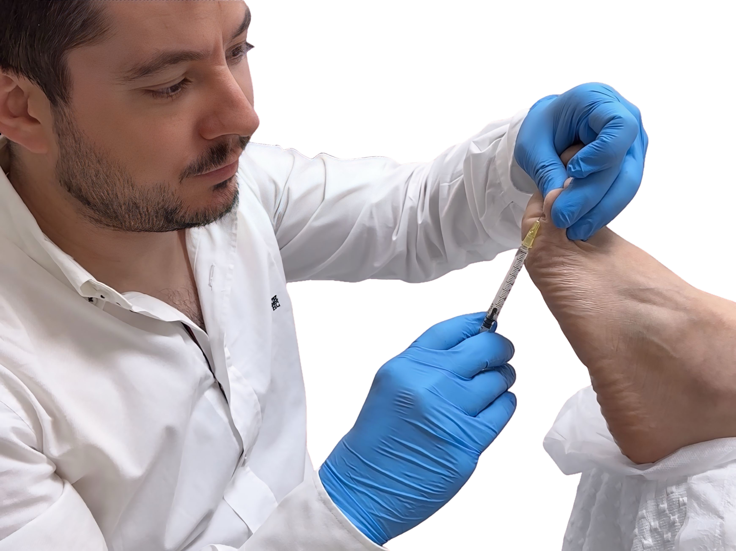 Precio del tratamiento de hiperhidrosis en Barcelona con toxina botulínica