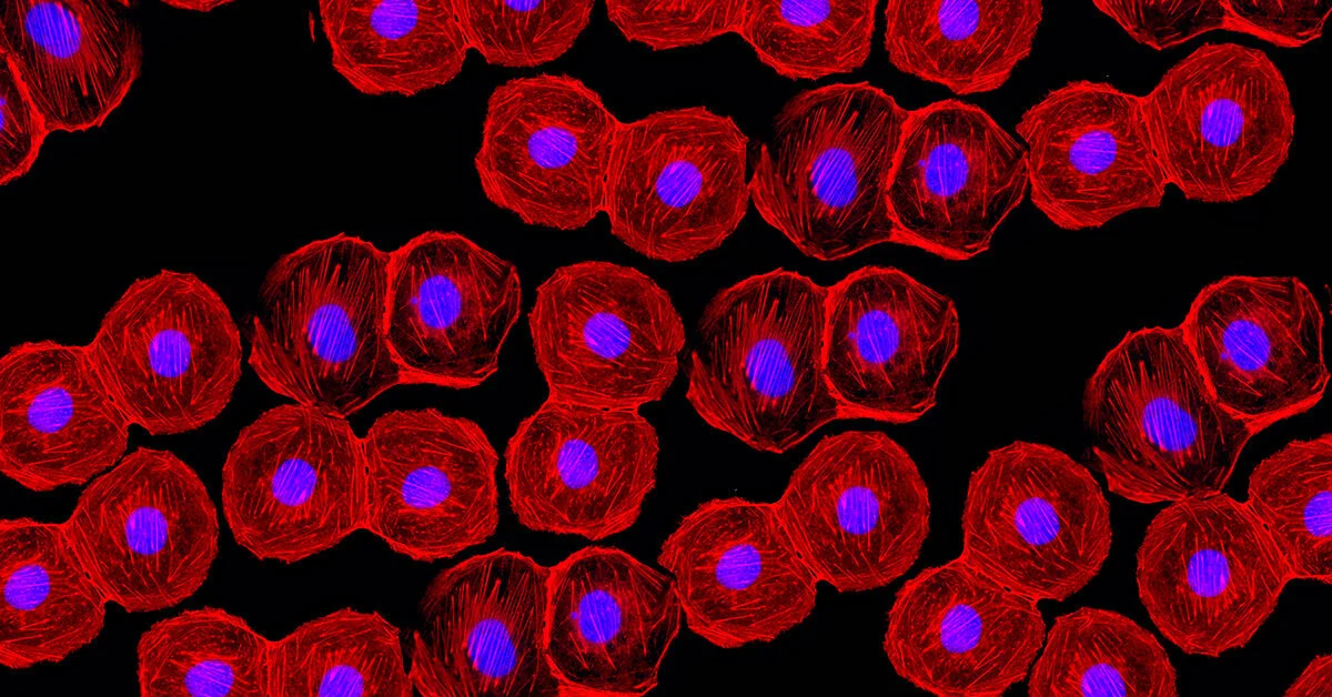 Can New Advances in CMOS Replace sCMOS Sensors in Biomedical Applications?