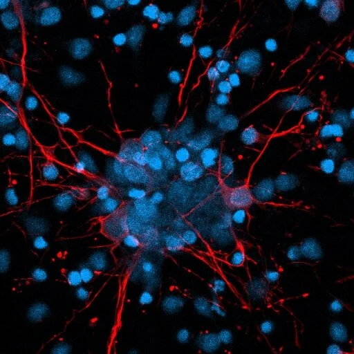 b3t diff z stack Extended Depth of Focus-04.jpeg