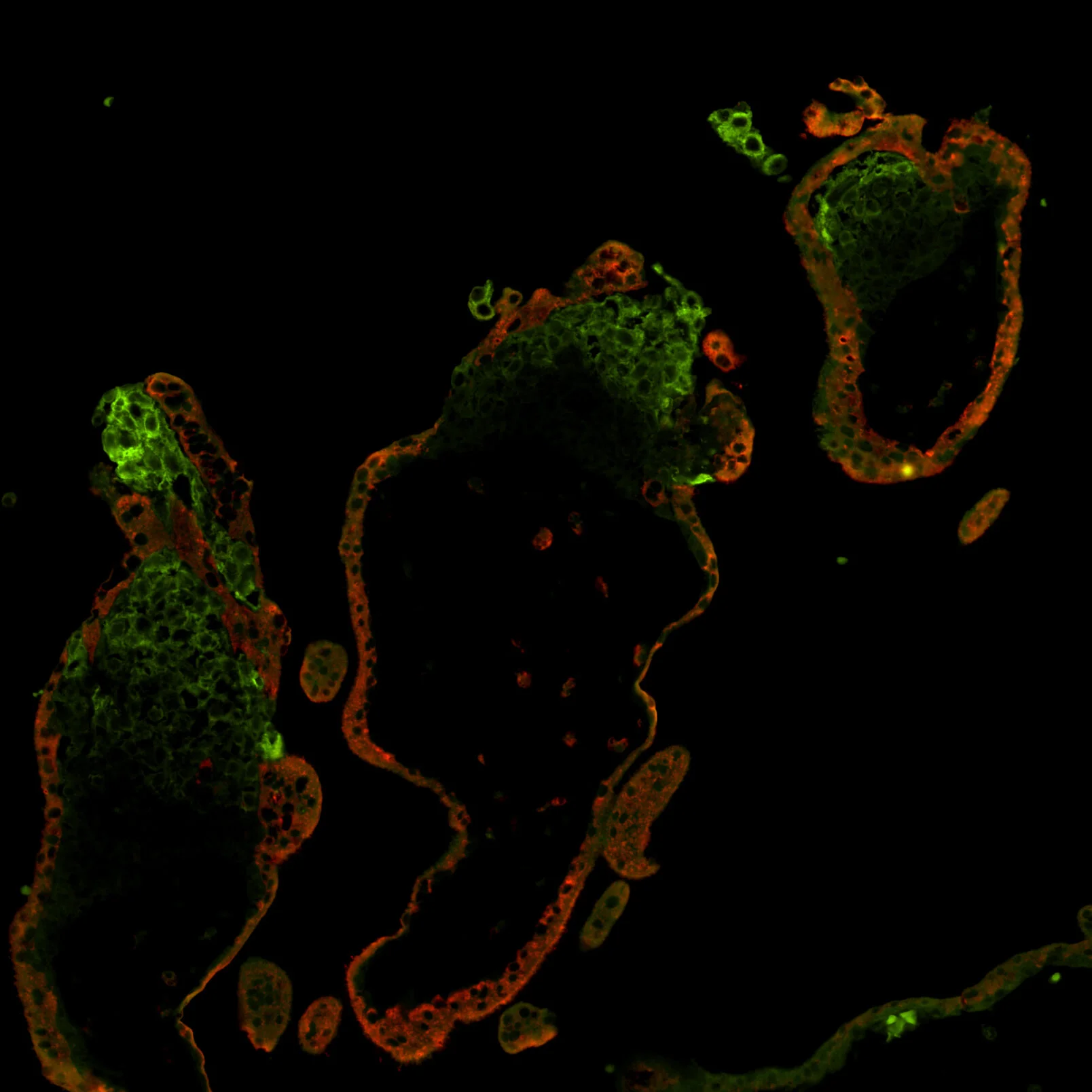 HDAC1+hCB June19.18 multichannel 2.jpg