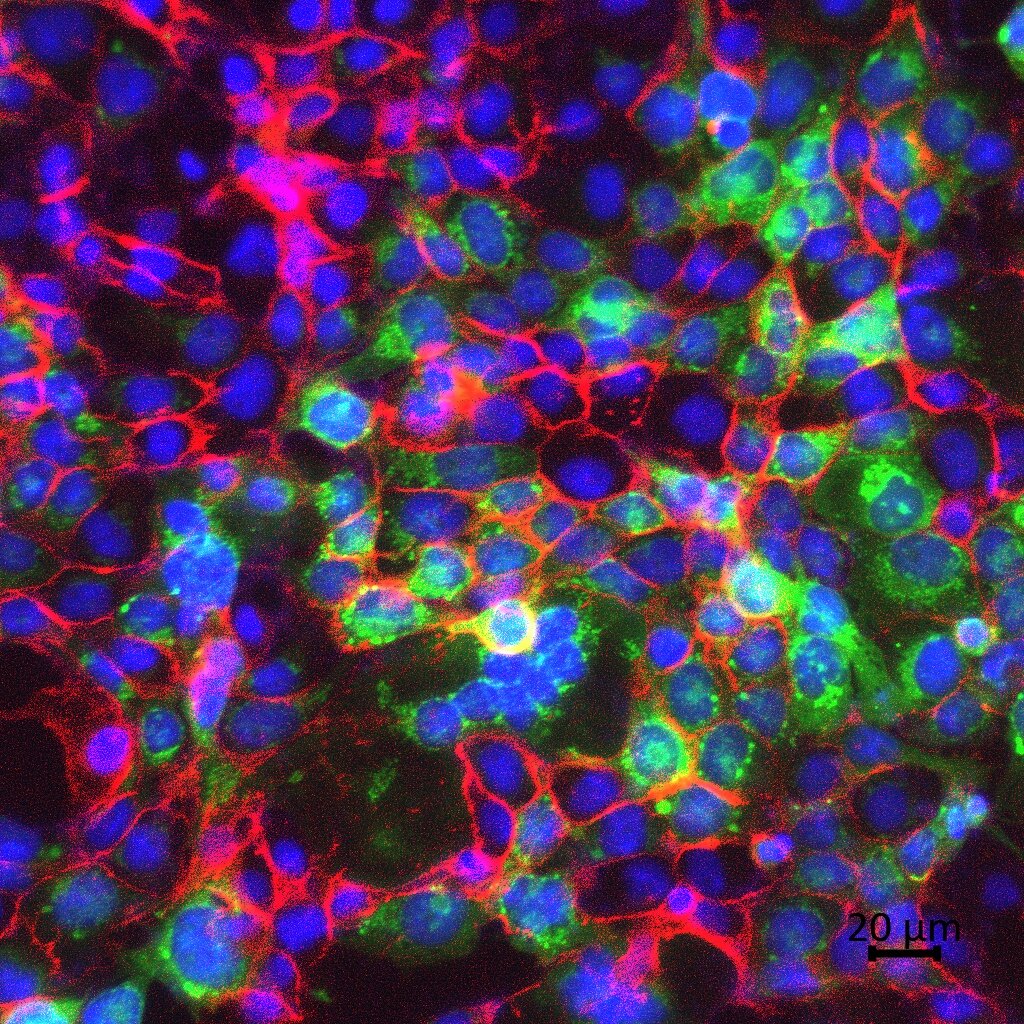 48 HRS 0 TSA scale_c1+2+3.jpg