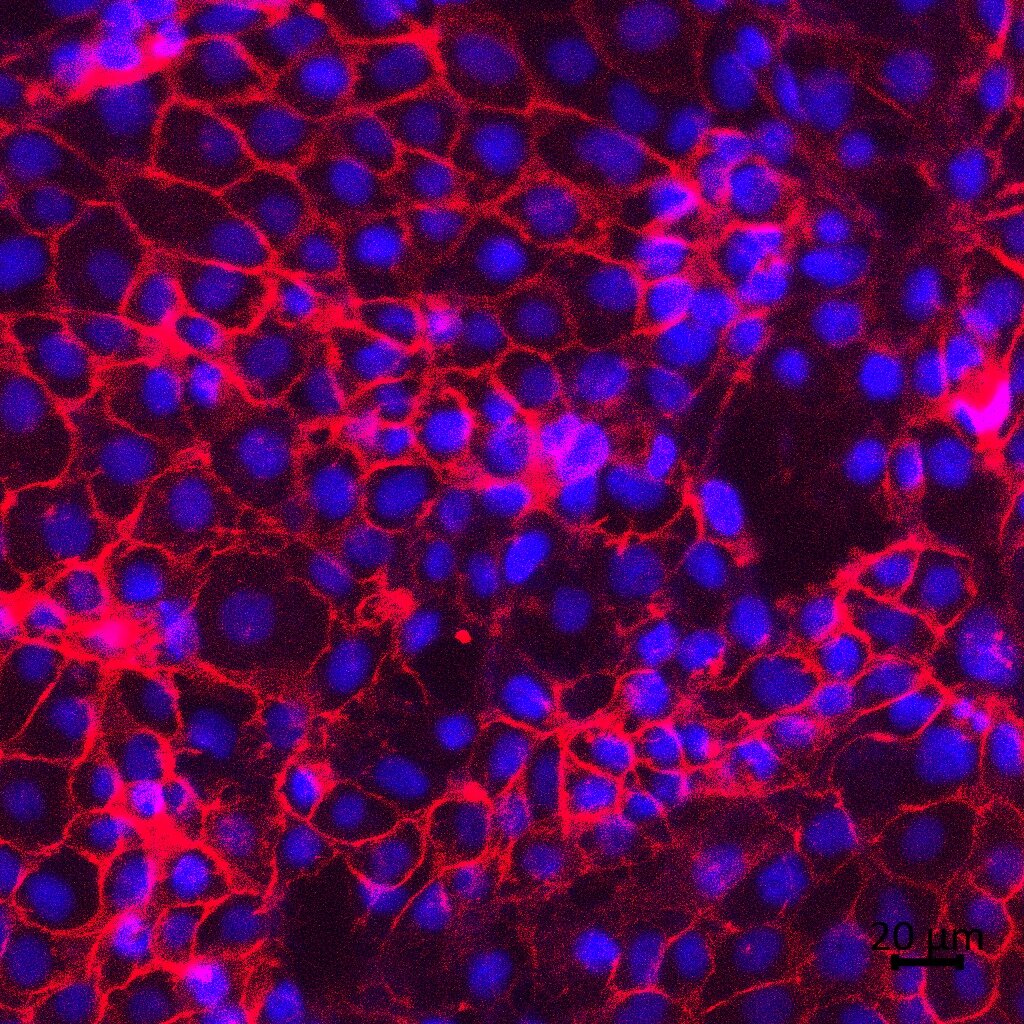 20 nM TSA DAPI + ECAD scale_c1+2+3.jpg