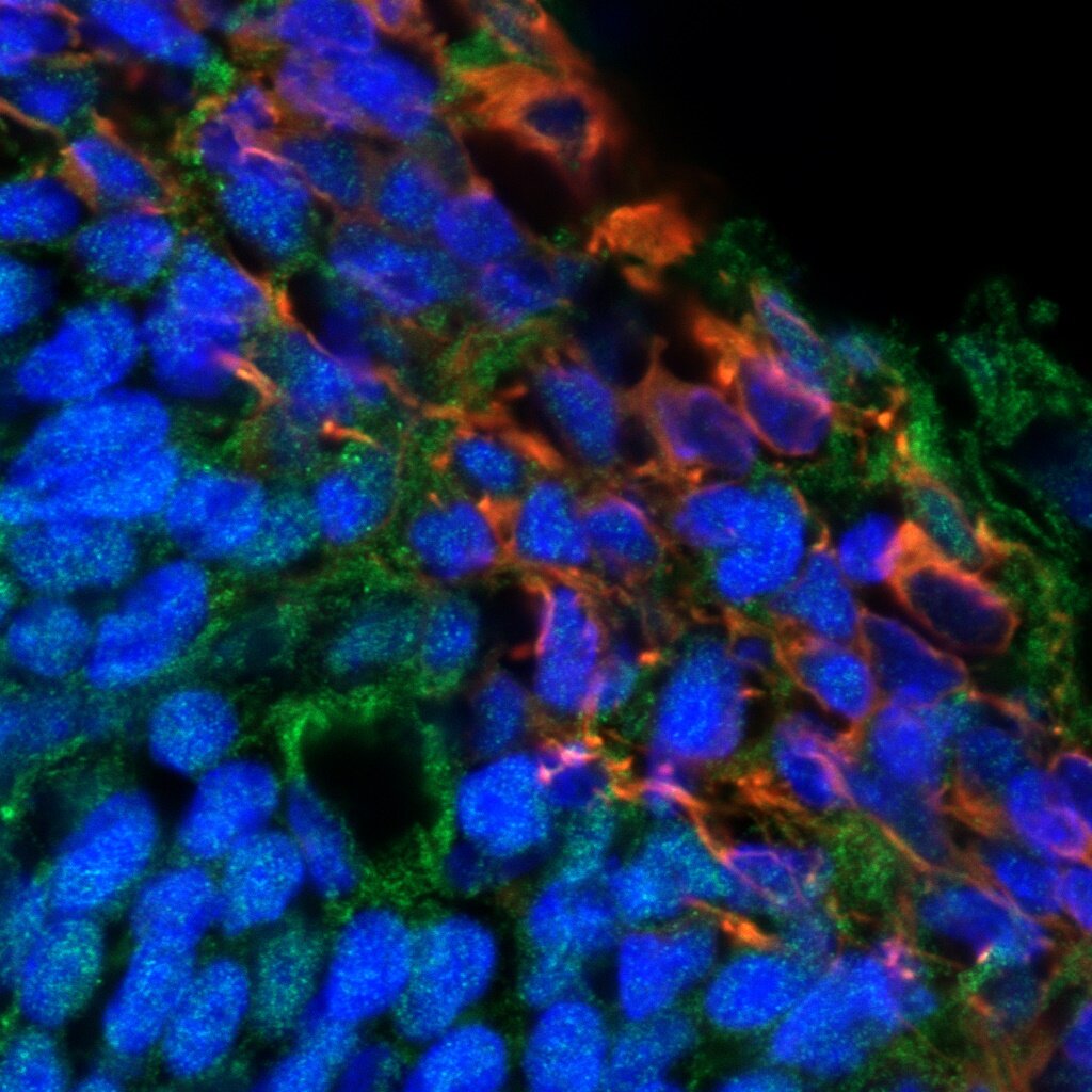 POLYIC 11_c1+2+3.jpg