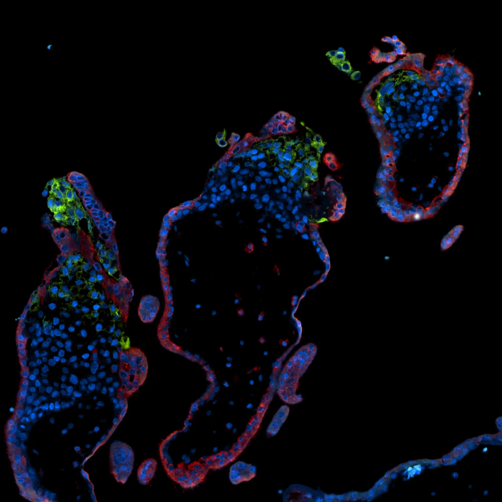 HDAC1+hCB June19.18 all channels 2.jpg