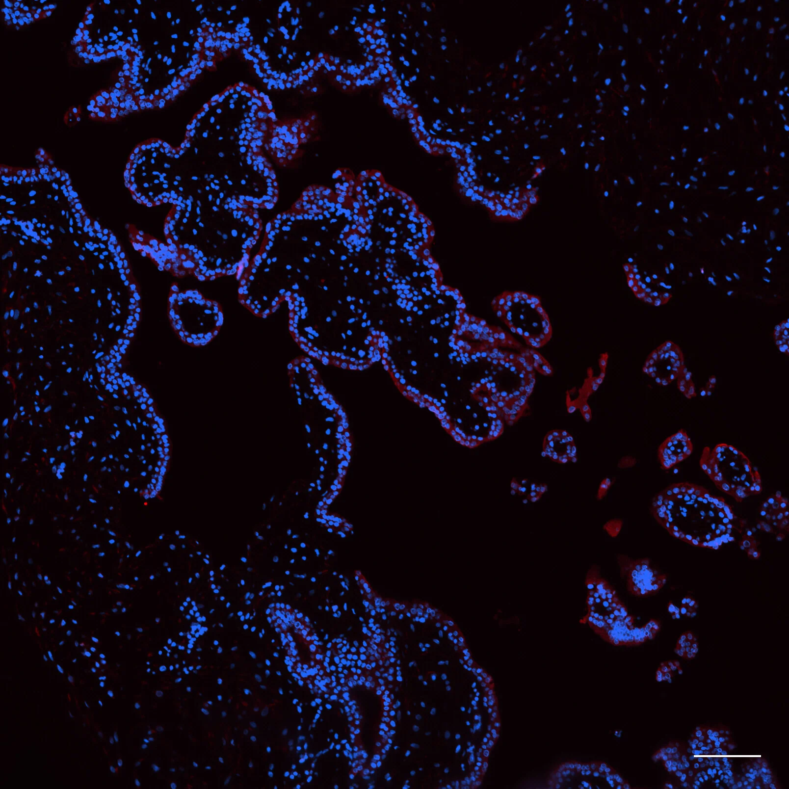6Week_DAPI_SDC4_10X_100uM.jpg