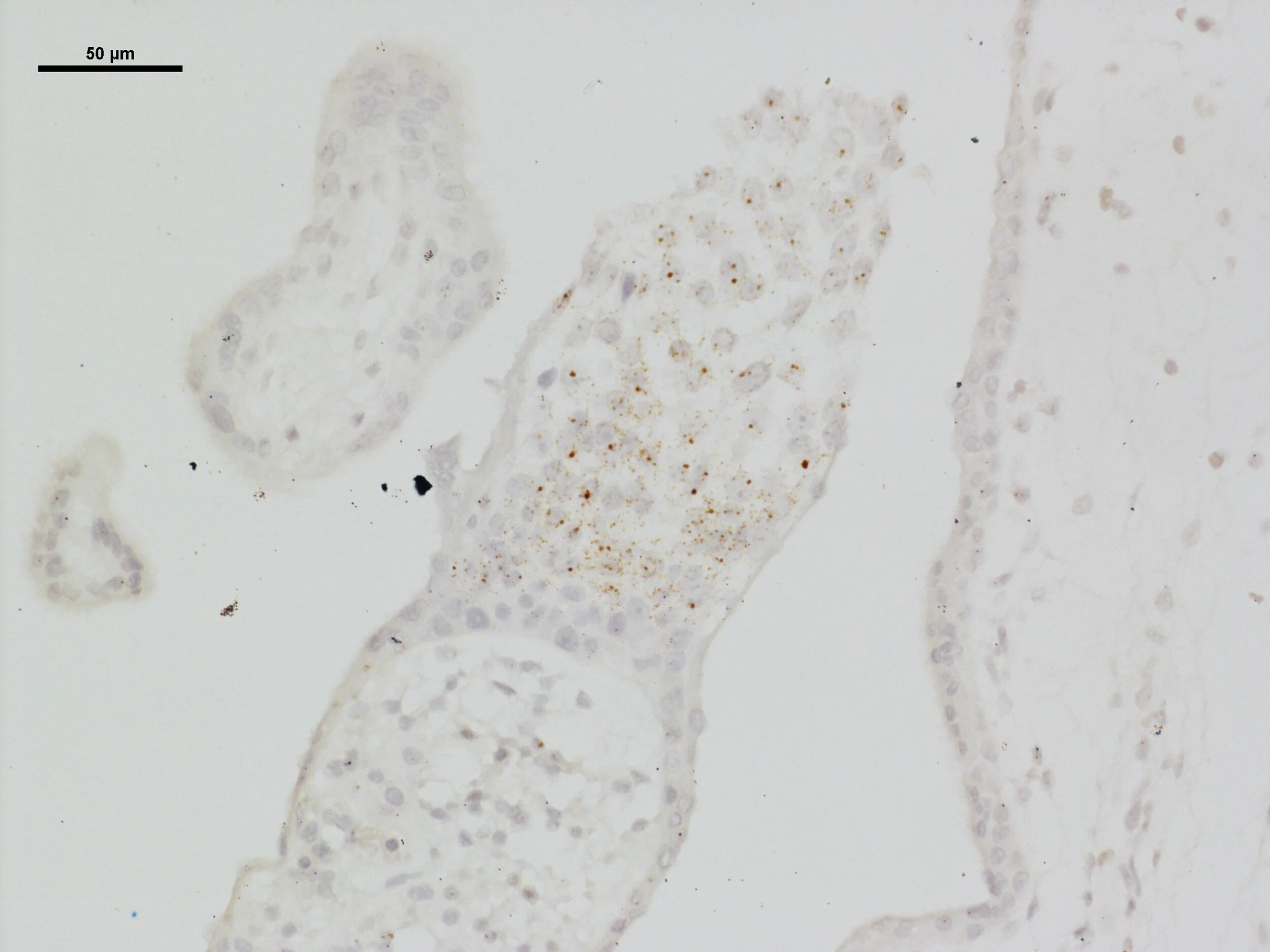 10 week ASCL2 20X 4.jpg