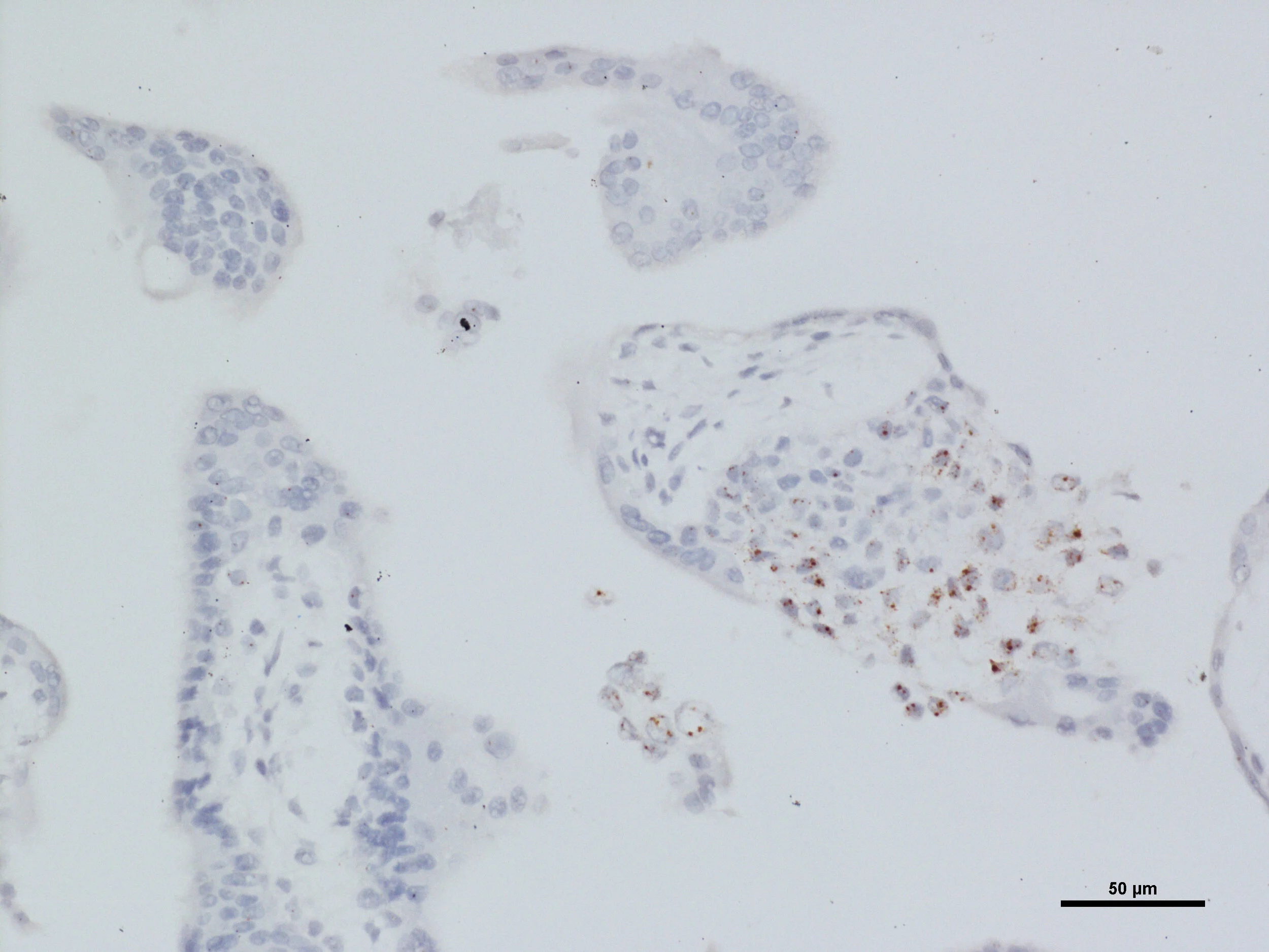 10 week ASCL2 20X 2.jpg