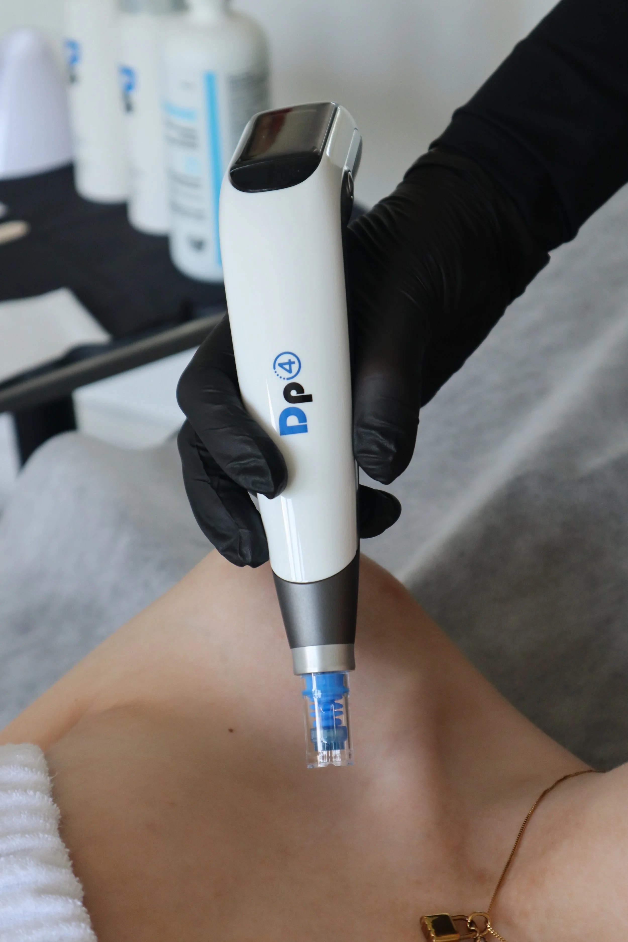 What Microneedling Is Actually Doing to Your Skin