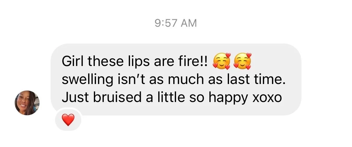 Girl these lips are fire!! Swelling isn't as much as lsat time. Just bruised a little so happy xoxo