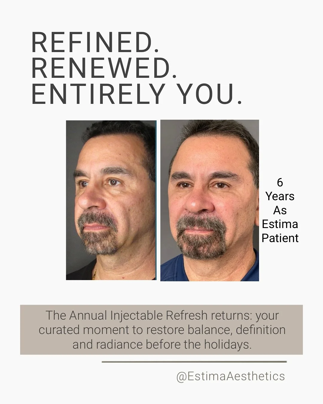 This season is your moment to restore balance, lift, and radiance. The Annual Injectable Refresh brings two exclusive Estima experiences, each designed with intention and artistry:
EMPOWER
A tailored transformation for precise renewal
Choose between: