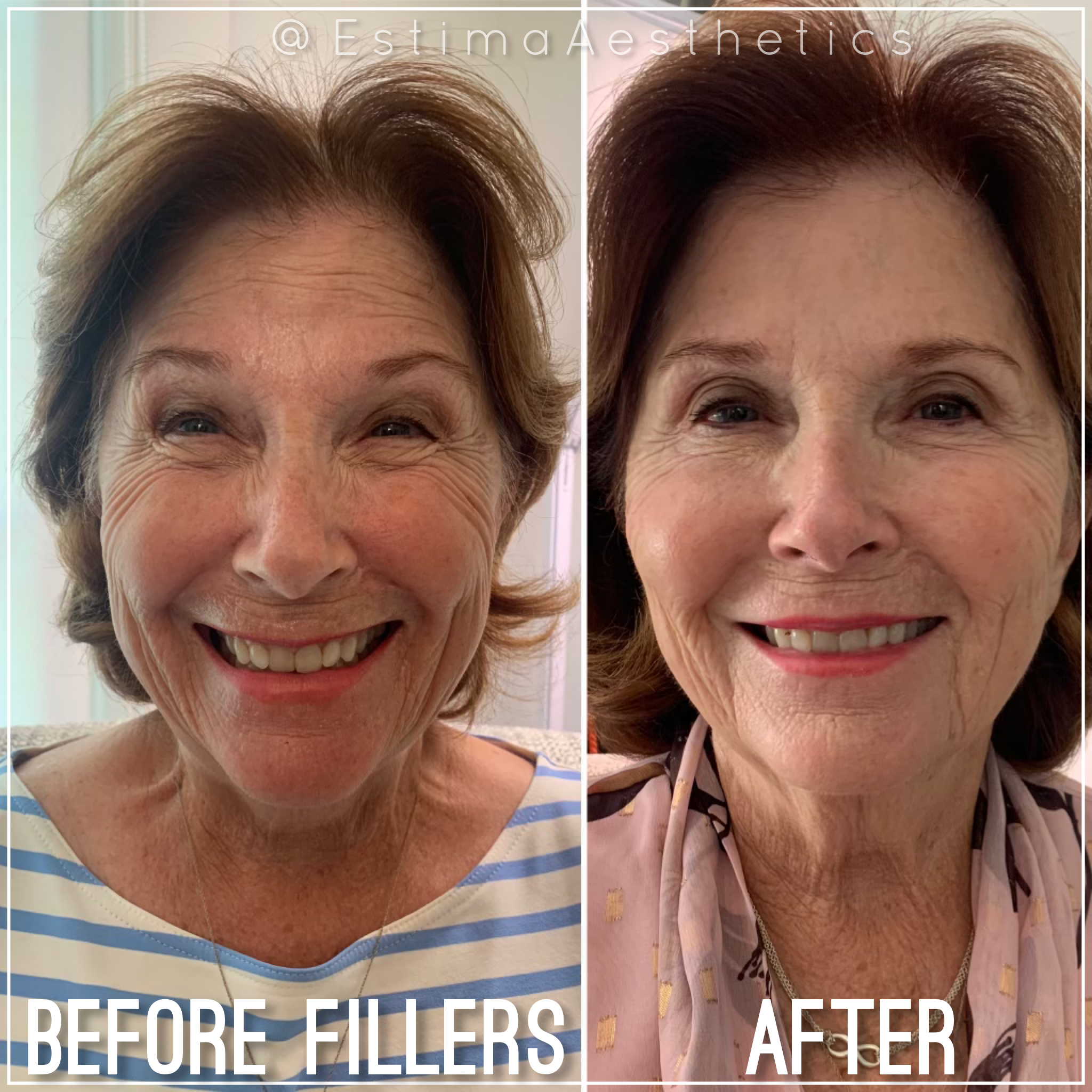 photo feb 21, 9 29 39 pm.PNG