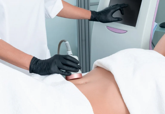 Lipofirm Body Contouring
