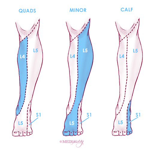 MS Diagram 6B.png