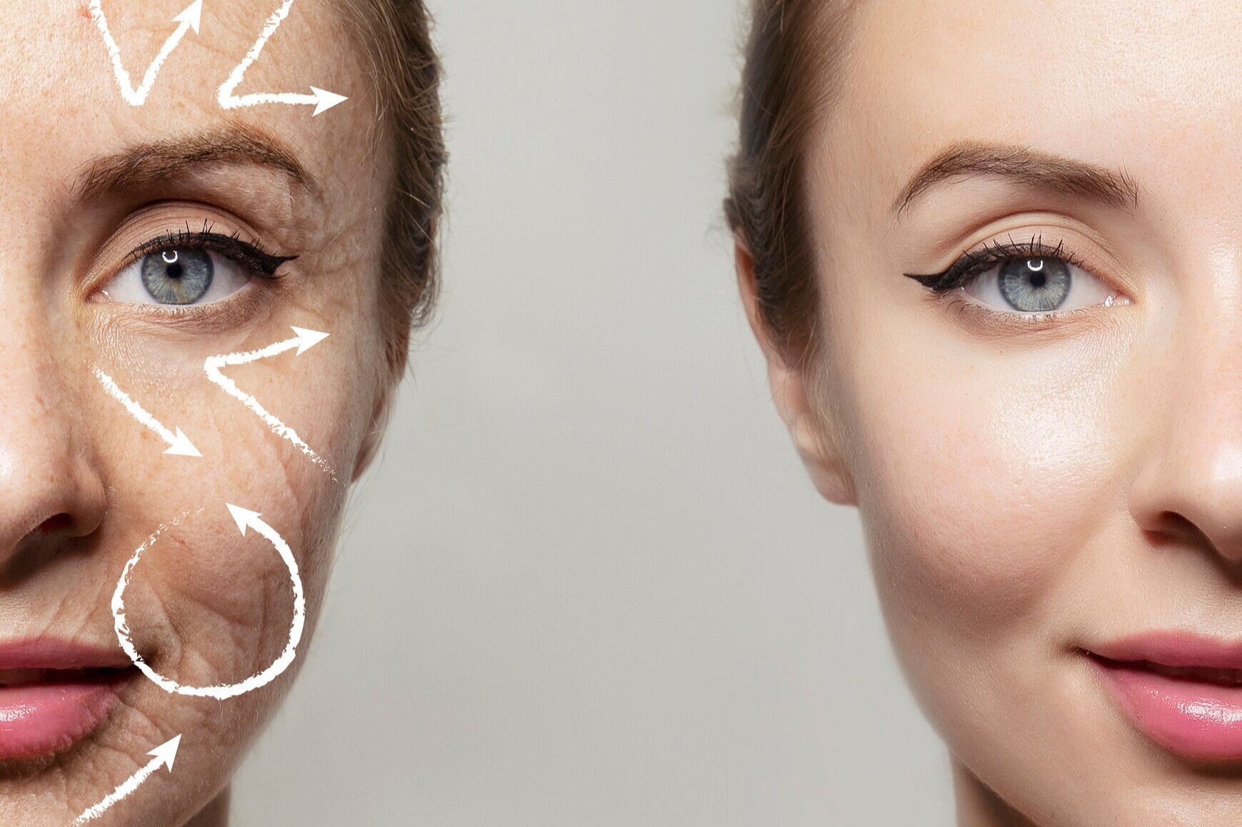 Natural Plant-based Anti-wrinkle Regime To Fight The Signs Of Aging