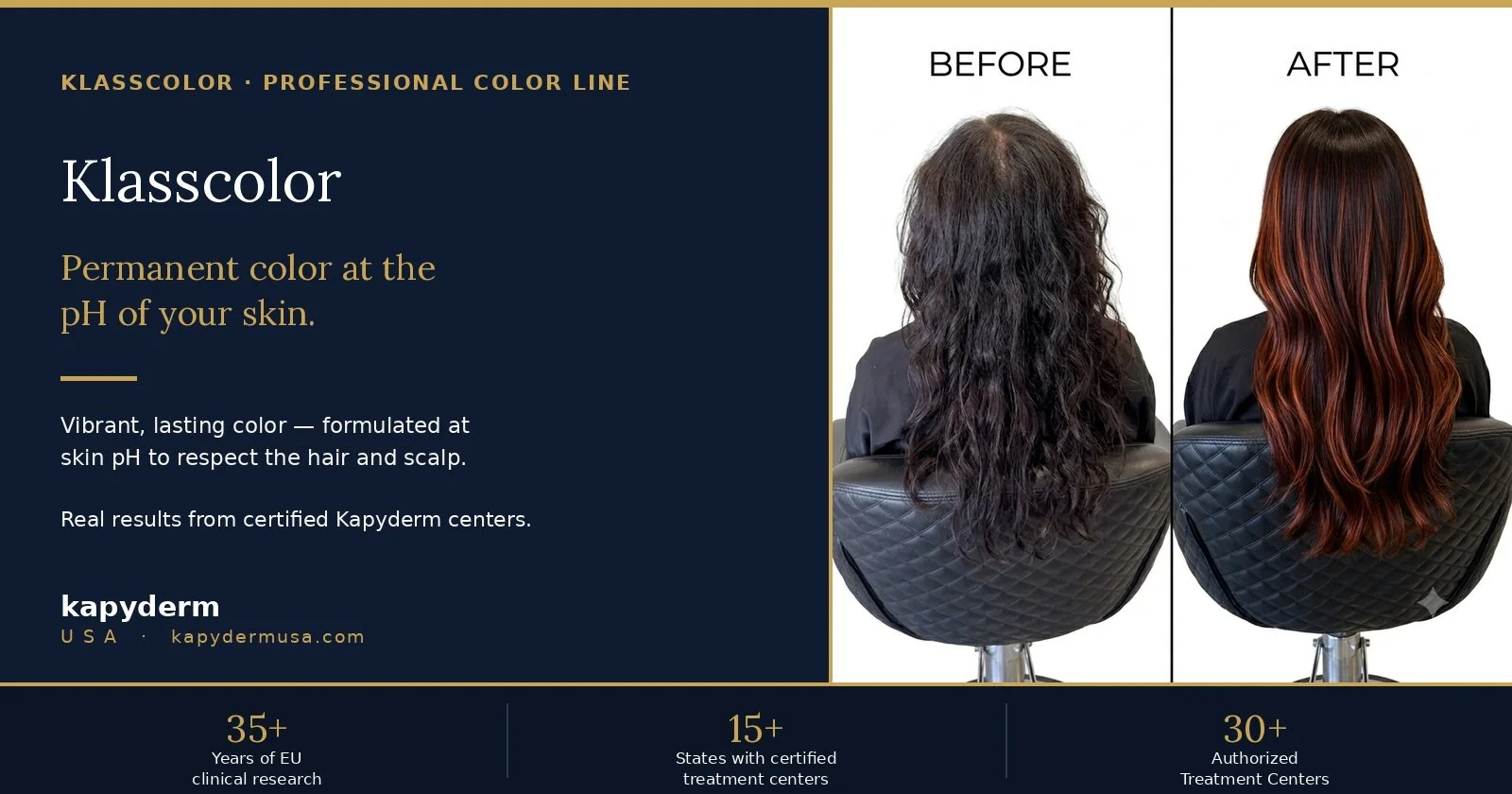      
  

 
  
     
 
 
 
 
 Klasscolor: The Acid Color System — Permanent Color at pH 5&ndash;5.5 | Kapyderm USA 
 
 
 
 
 
{"@context":"https://schema.org","@type":"Article",
"headline":"Klasscolor: Permanent Color at the pH of Skin",
"description