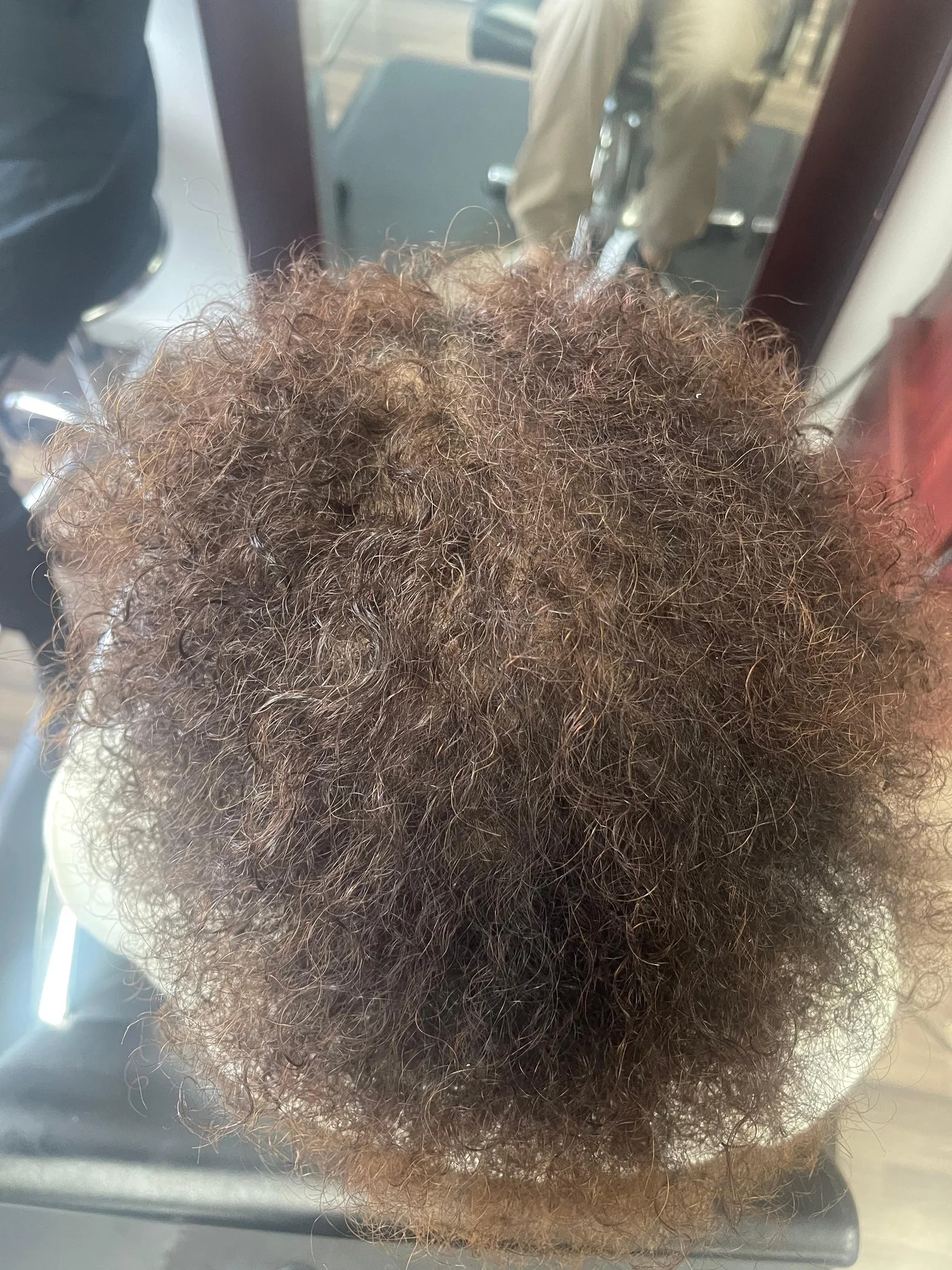 After 16-week plant-based Dermotricology protocol — crown density restored in androgenetic alopecia patient, dense coily hair growth, scalp no longer visible, Mendoza Dermotricology Solutions