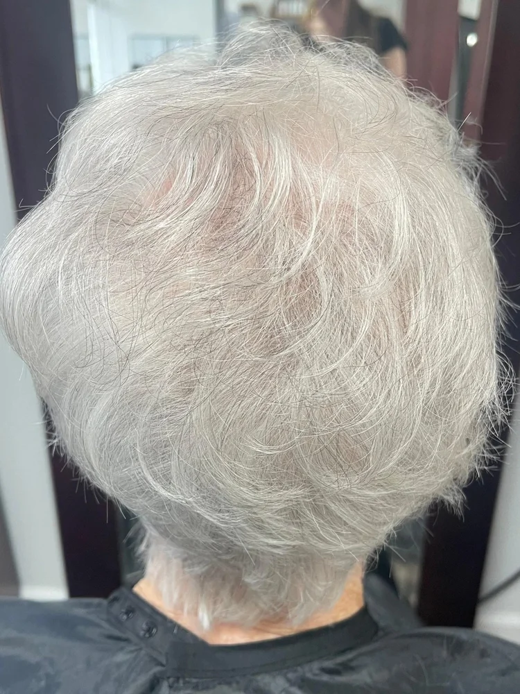 After 6-week Dermotricology protocol — full crown density restored in elderly female Telogen Effluvium patient at Mendoza Dermotricology Solutions Pooler GA