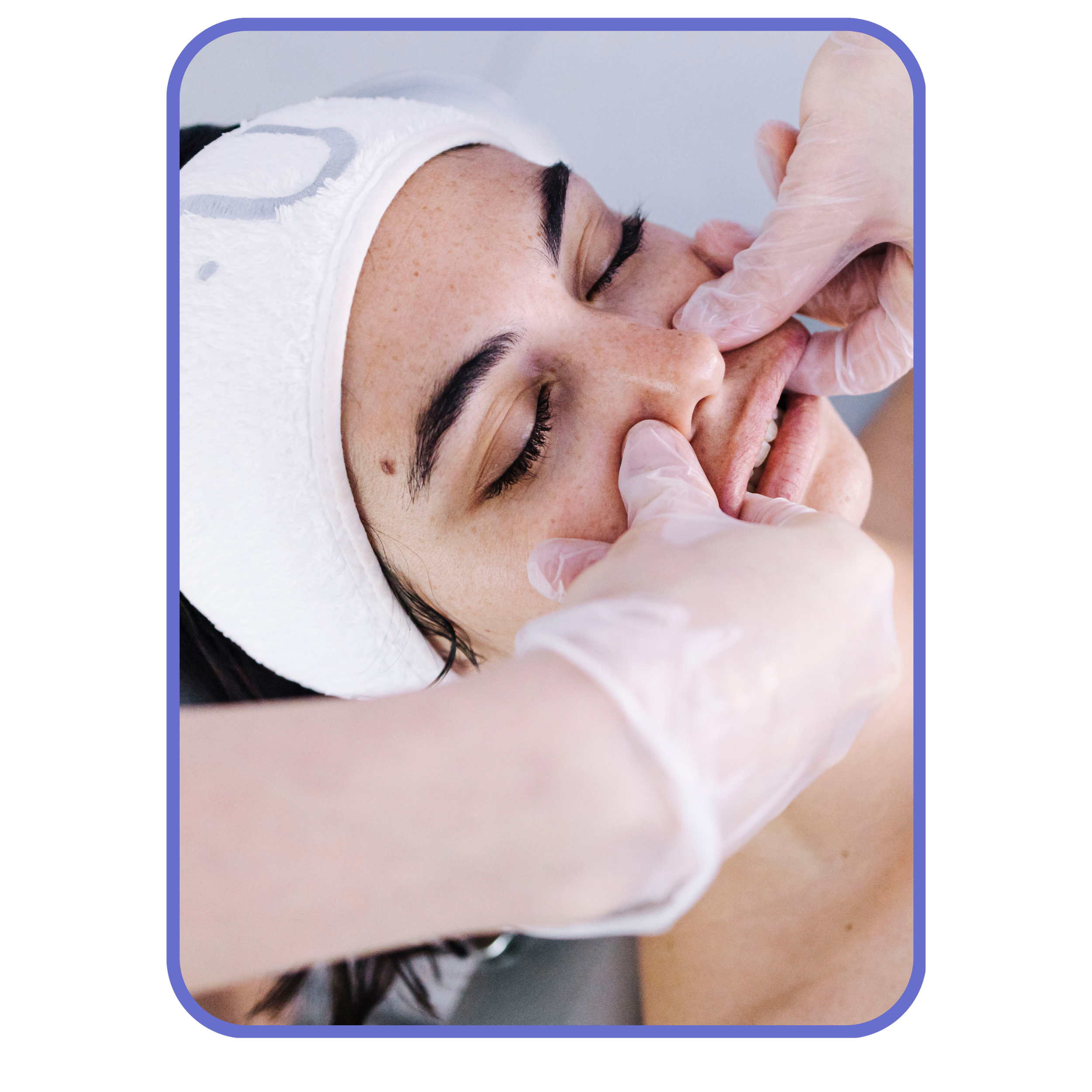 intra oral buccal facial
