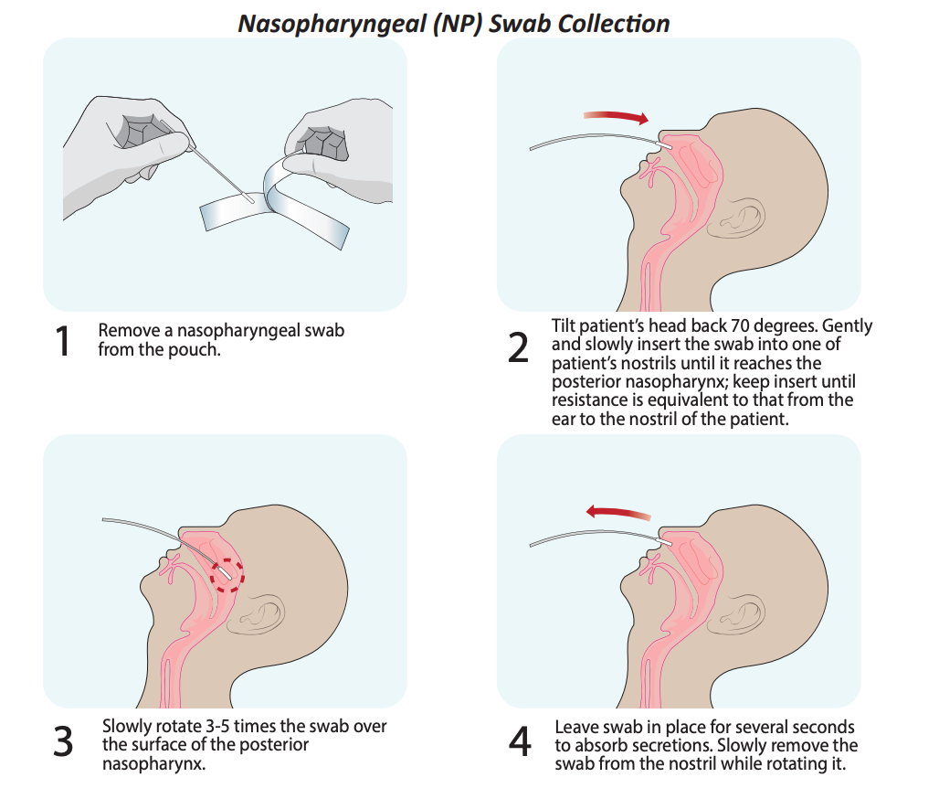 Nasopharngeal (NP) Swab Collection - Rapid Antigen Test Specimen Collection and Handling