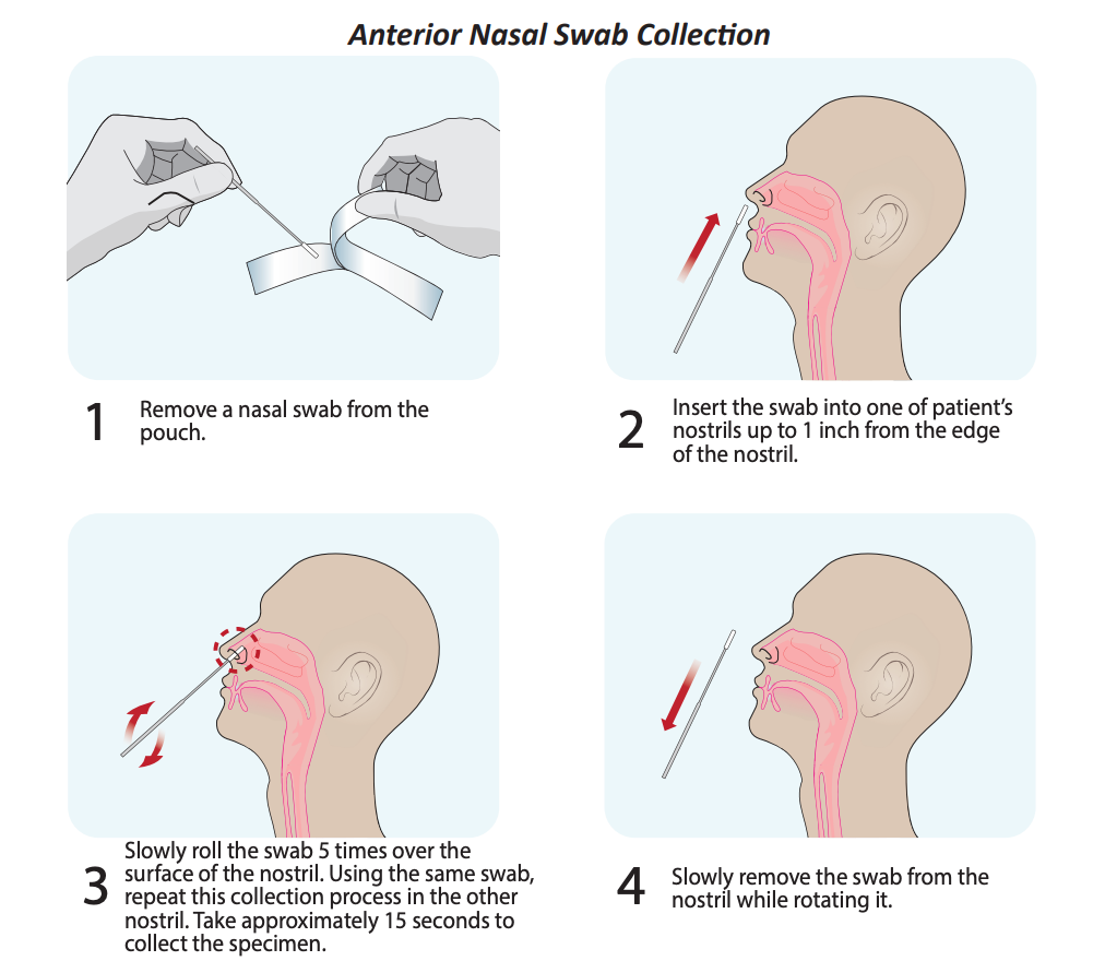 Anterior Nasal Swab Collection - Rapid Antigen Test Specimen Collection and Handling