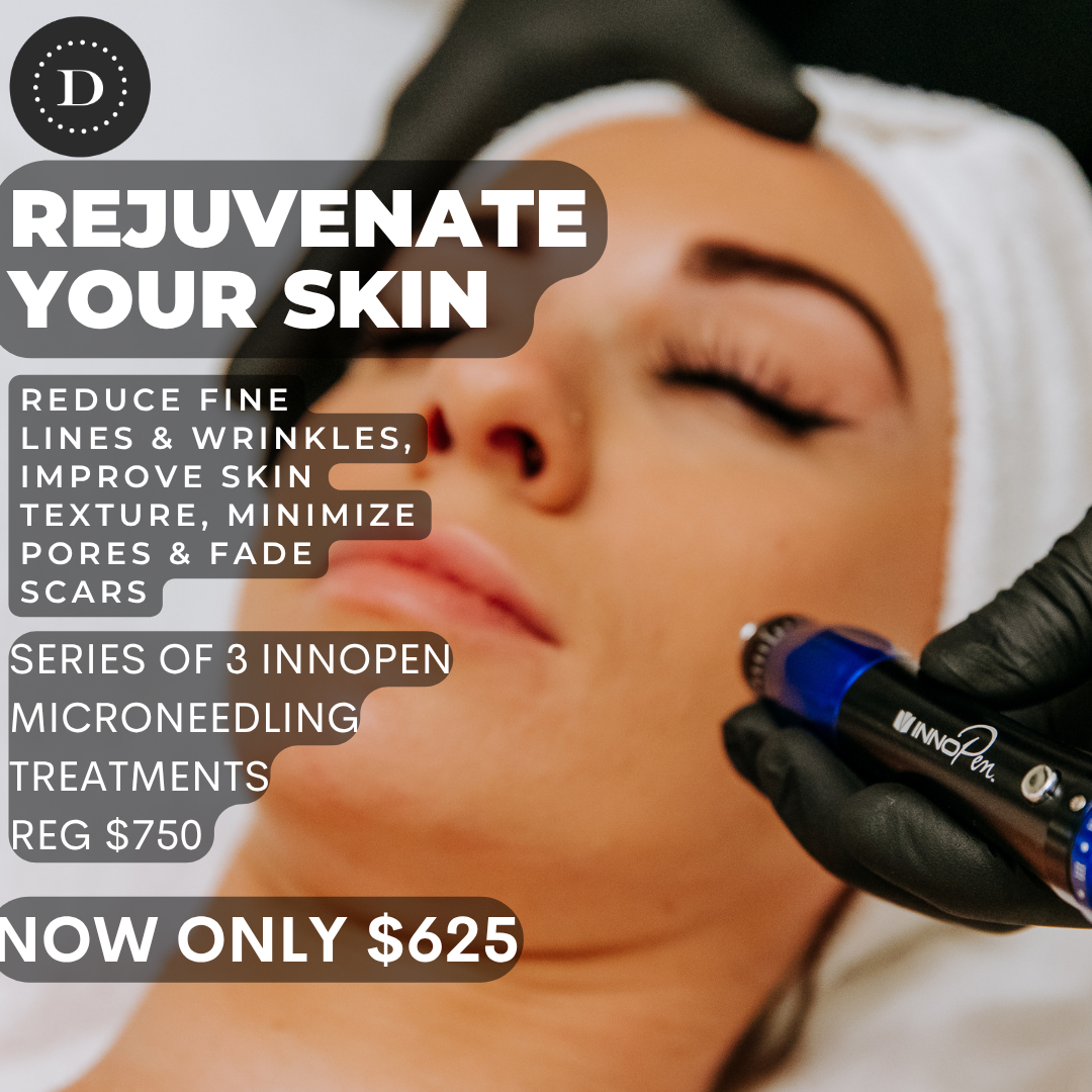 Series of 3 Innopen Microneedling Services