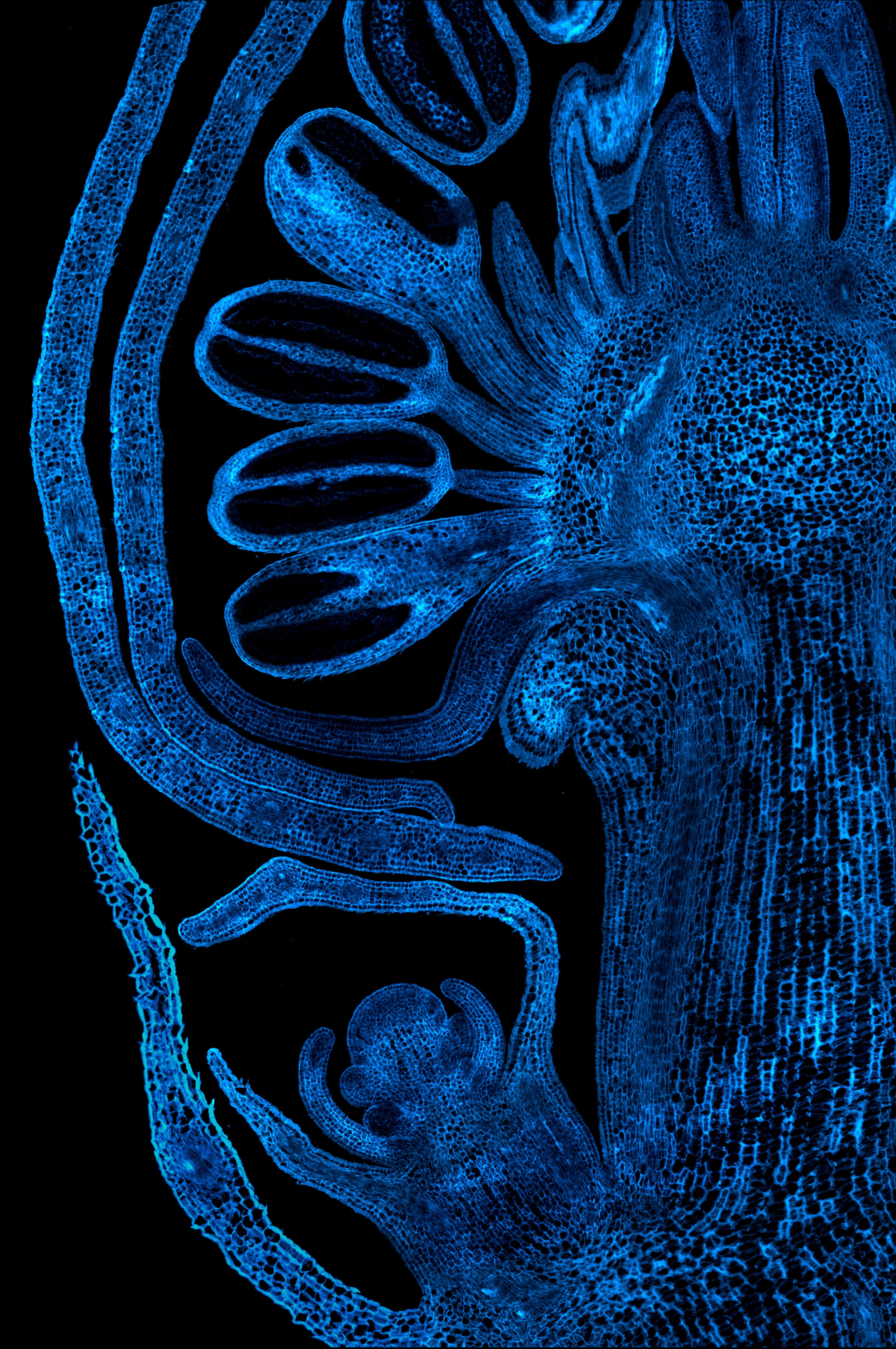 MinYa-2018 Fall Ecdysis-bud section.jpg