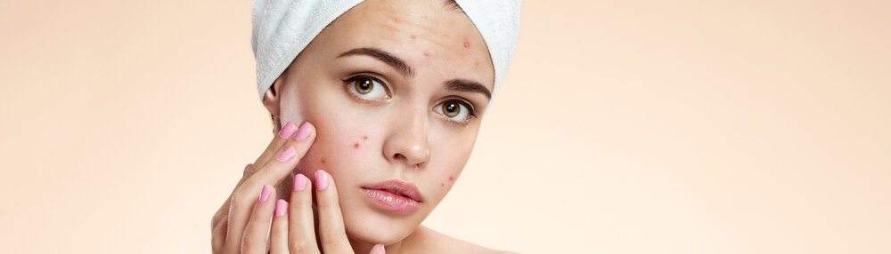 Acne Treatments — Better Health Medical Group
