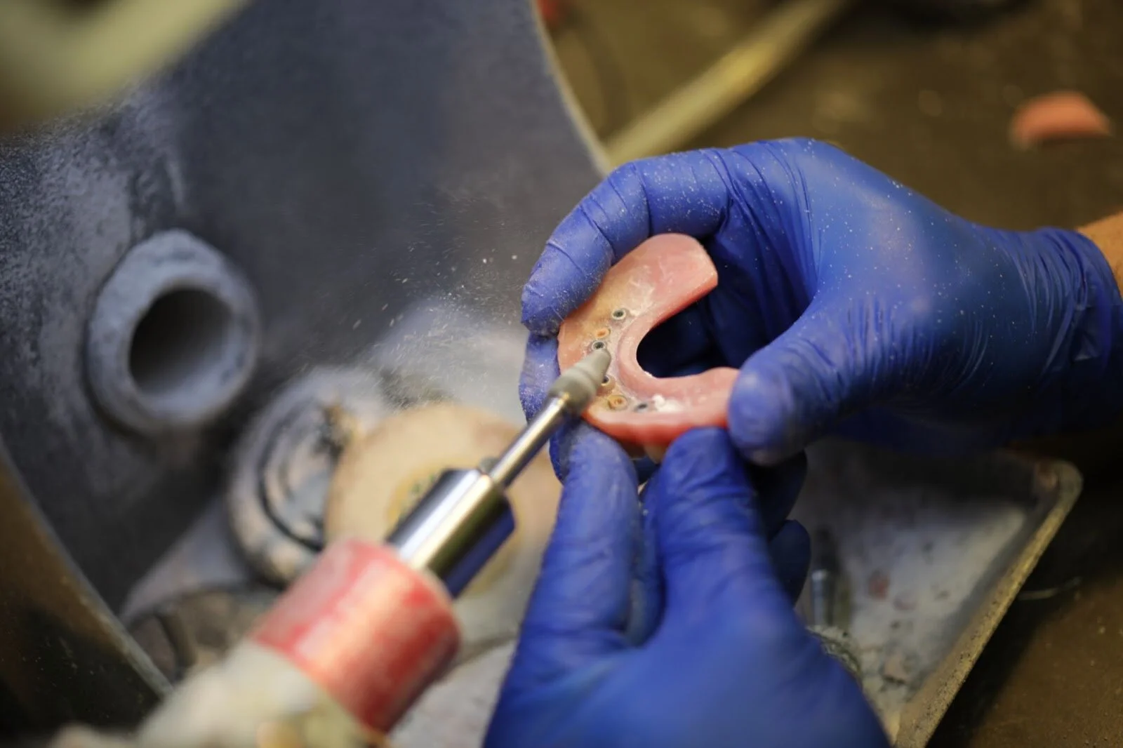 Dental Implants for Multiple Missing Teeth