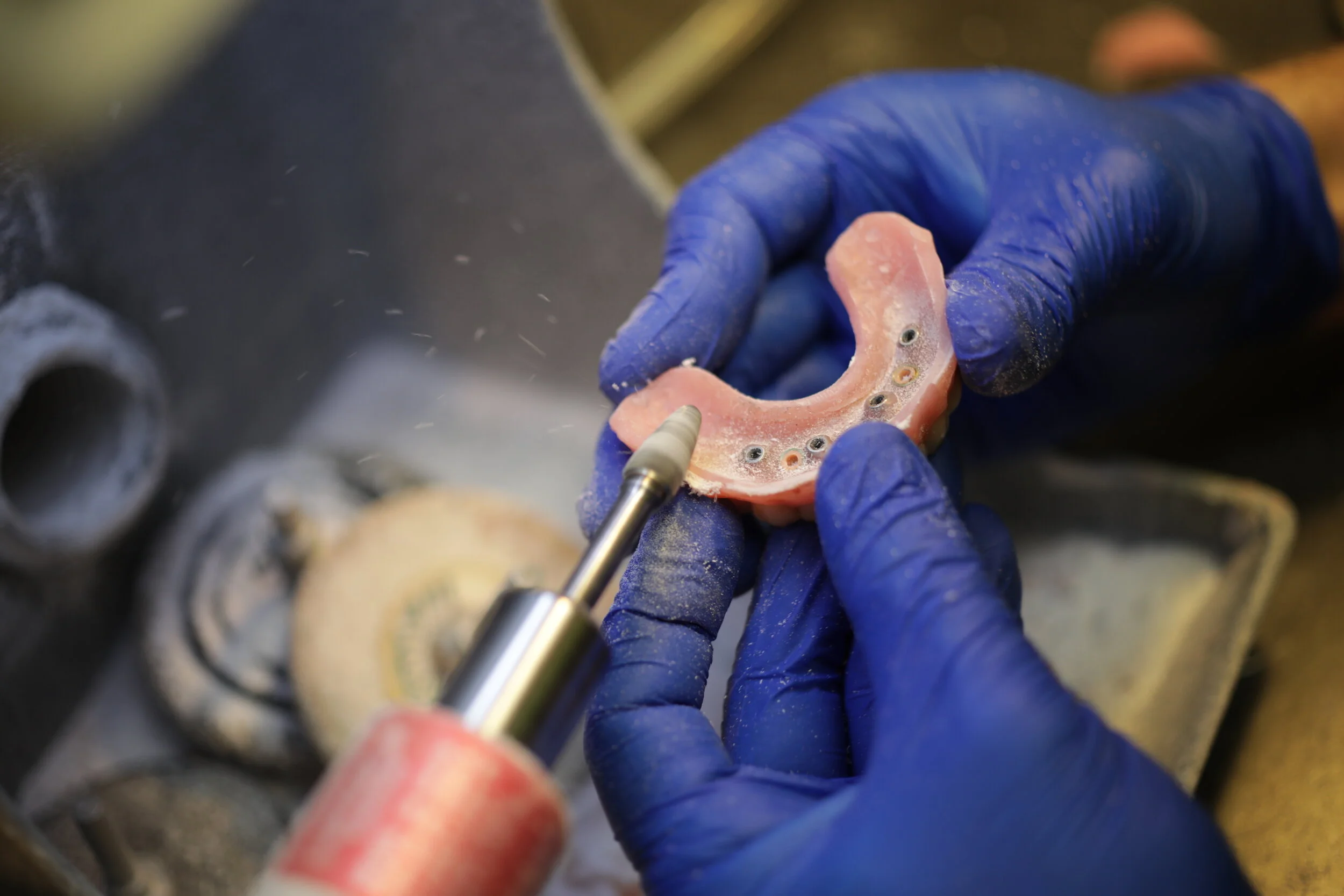 What is the Best Alternative to Dentures The Complete Guide Stabili