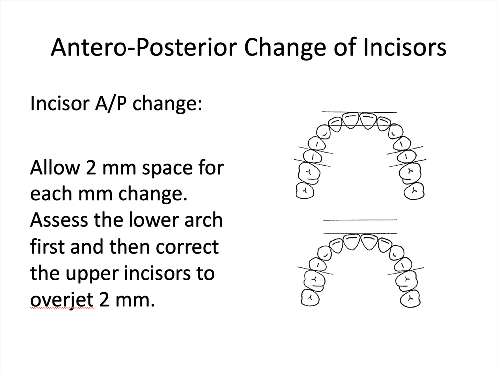 Royal London Space Analysis (RLSA) — Cephtactics Dental