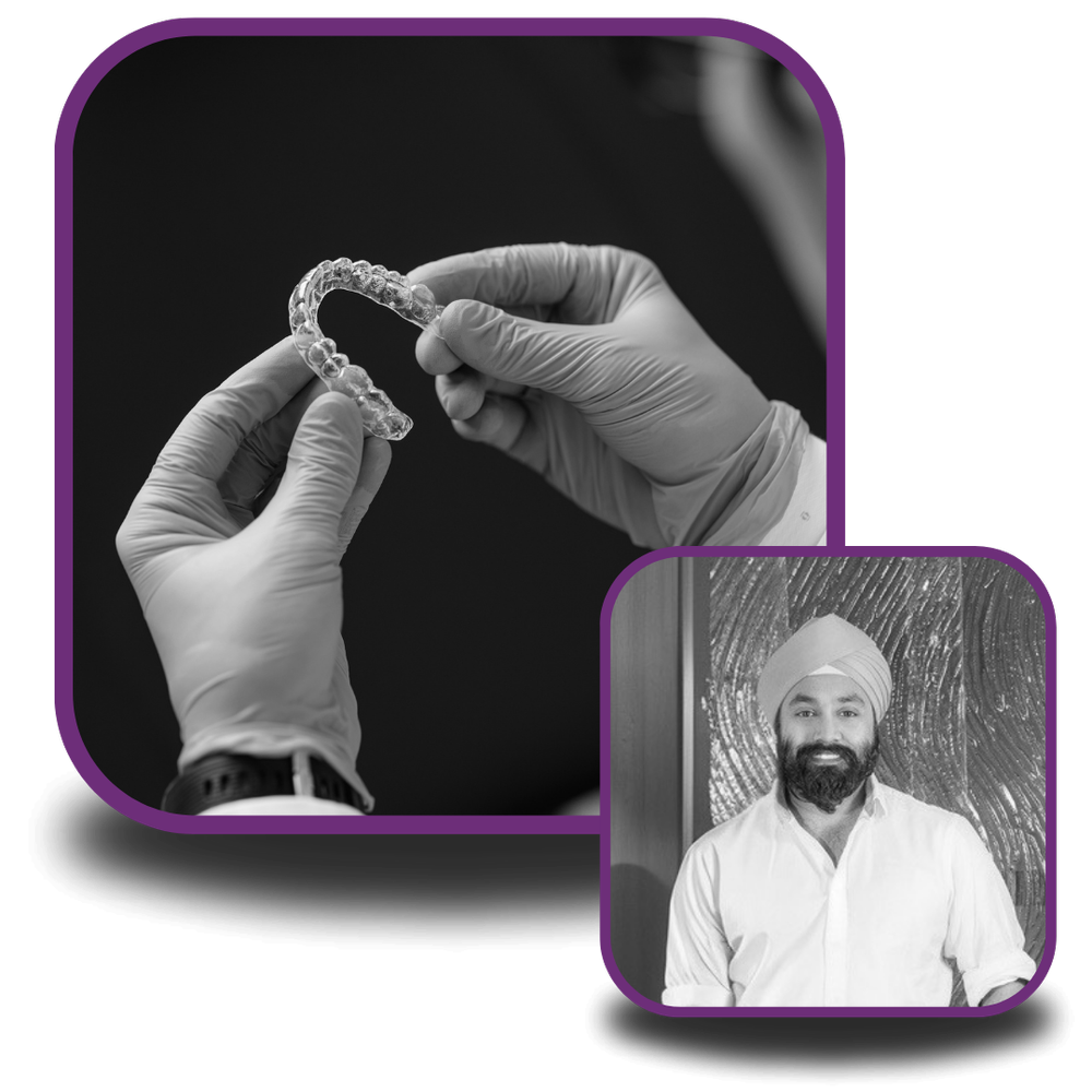 Aligner Biomechanics