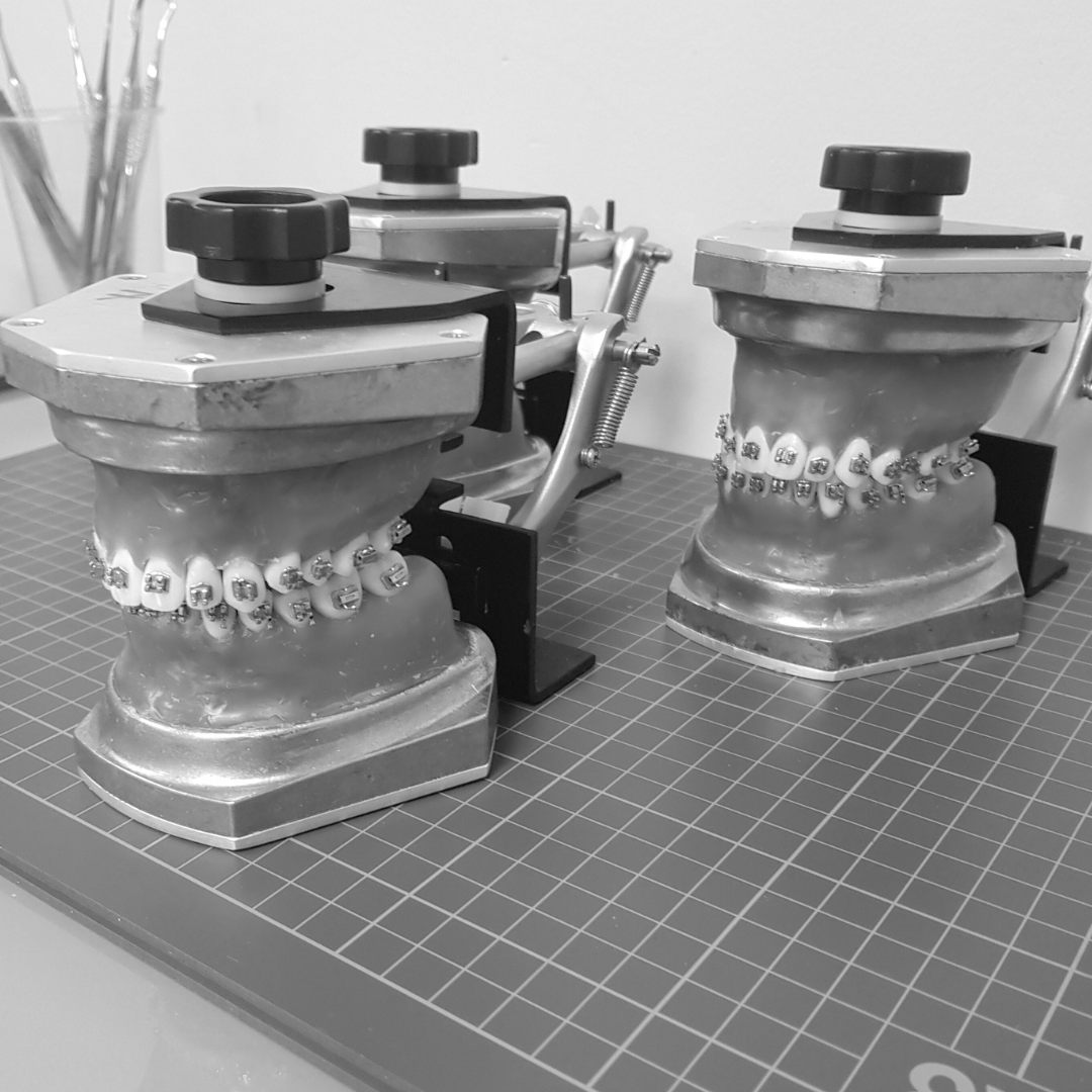 “Orthodontic dental models with braces in lab – Cephtactics practical teaching for dentists on retention and appliance design.”