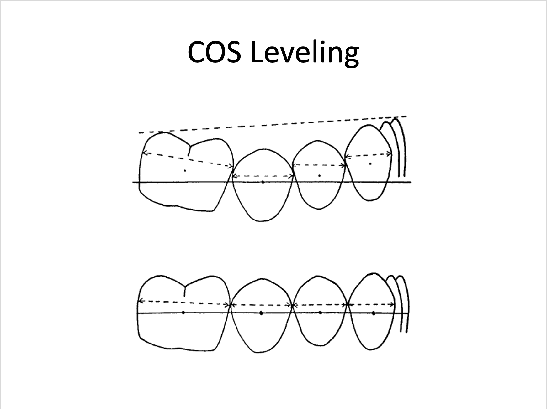 Rlsa Process Royal London Space Analysis (RLSA) — Cephtactics Dental