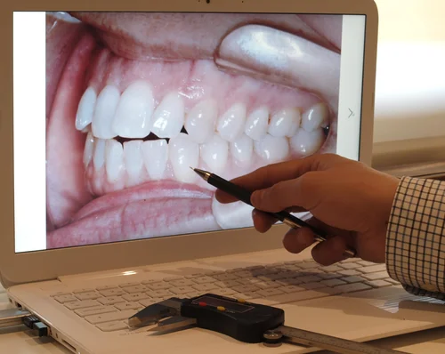 Orthodontic practical training