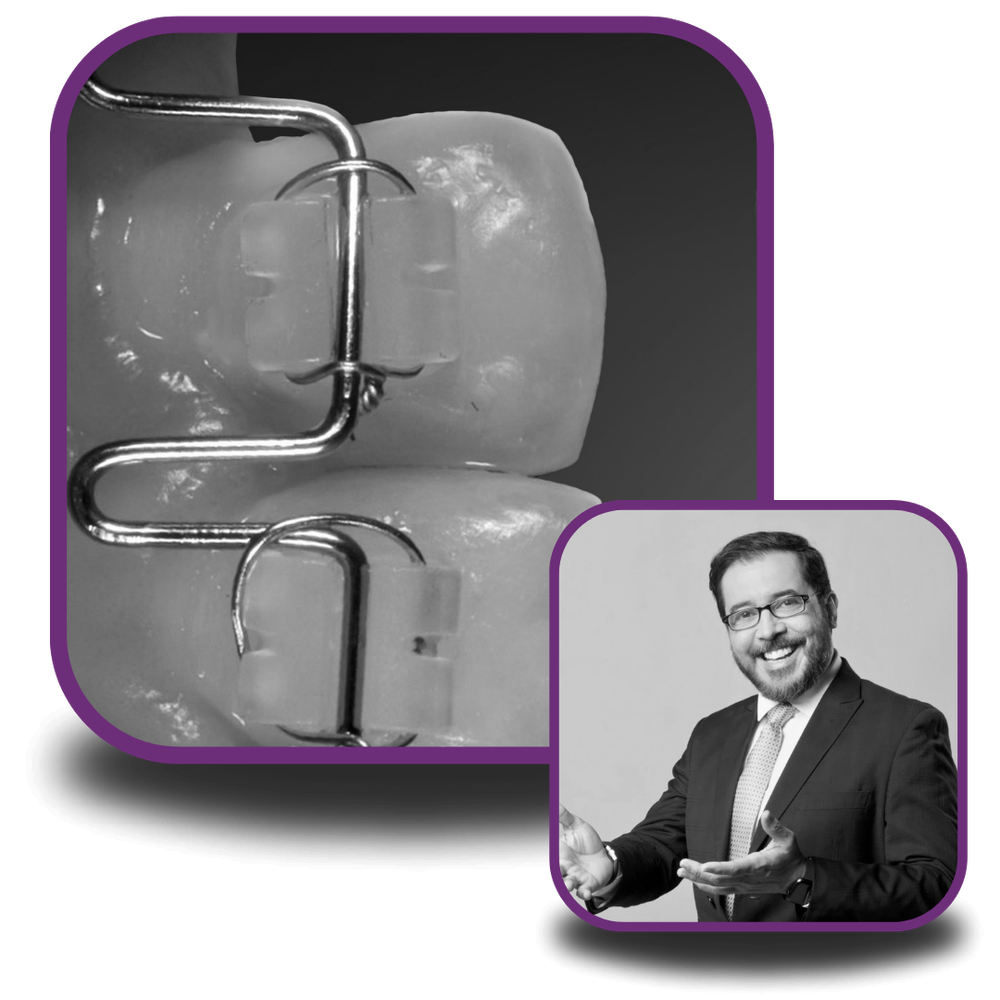 Advanced Orthodontic Biomechanics