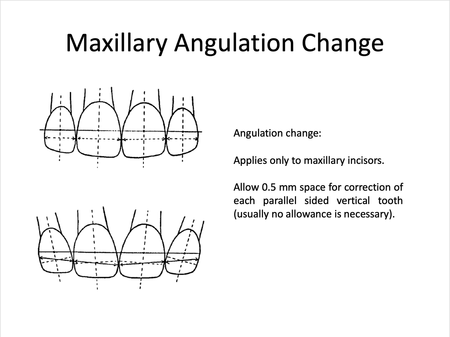 Royal London Space Analysis (RLSA) — Cephtactics Dental