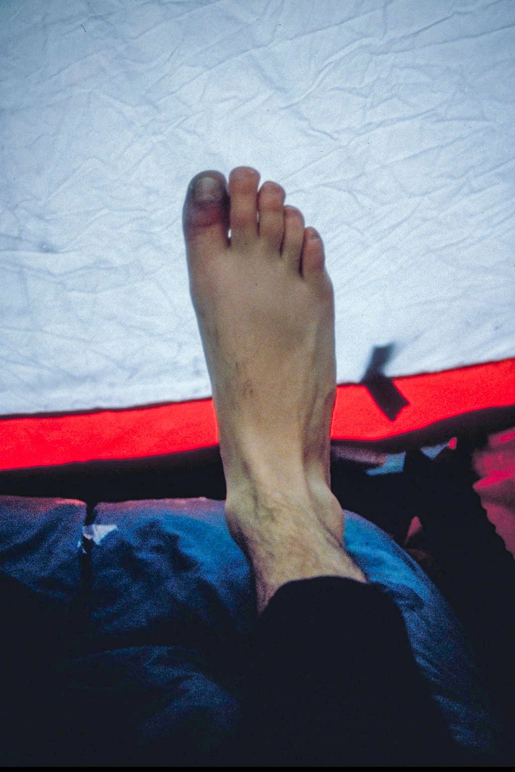 Day 4. Waking up in the morning only to discover Scott had frostbite. Now a 2 man team is cut down to 1 as we can't risk refreezing his frozen extremities. I returned to the lake to retrieve more food and medical supplies. (image 20 of 22)
