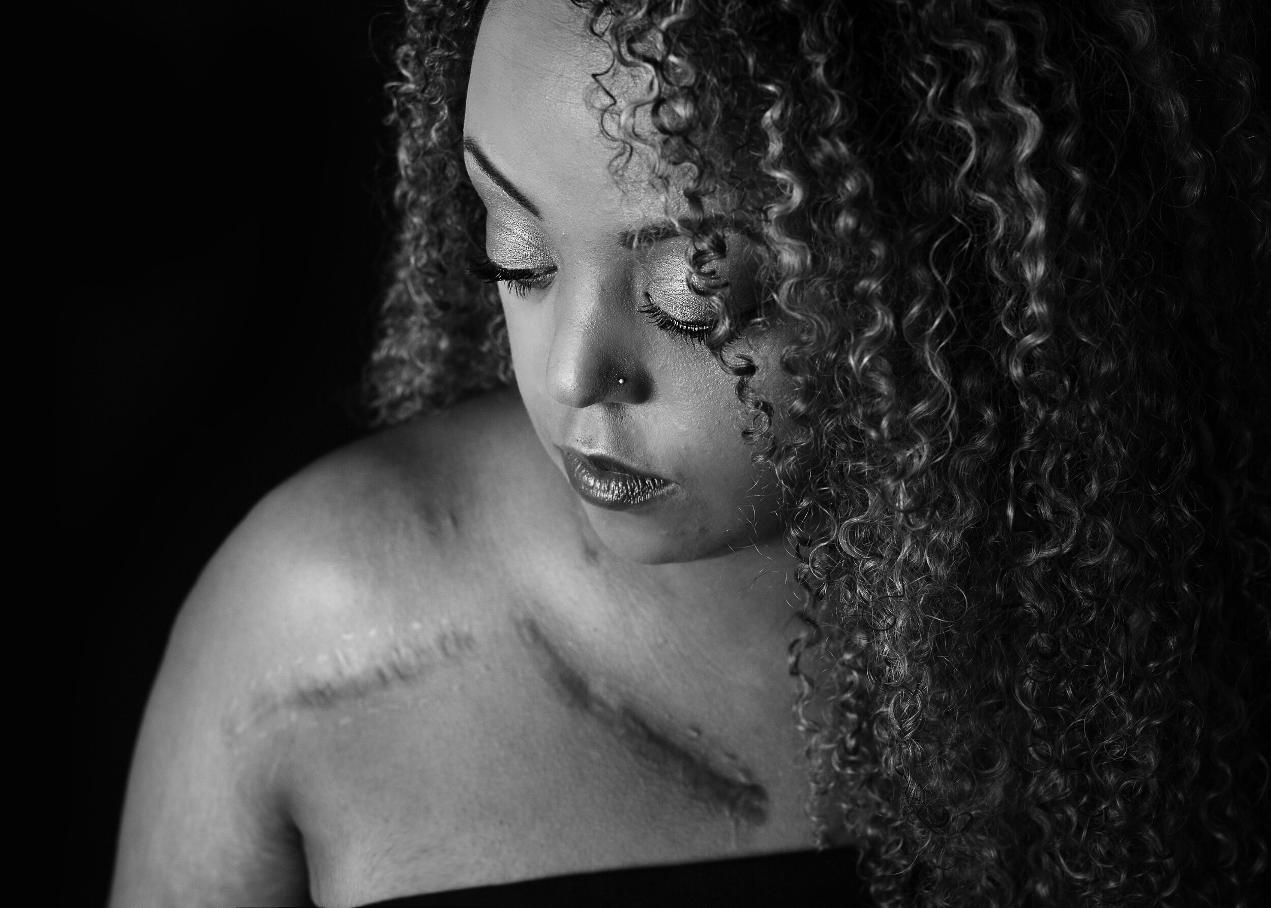 Scars-9415BW.jpg
