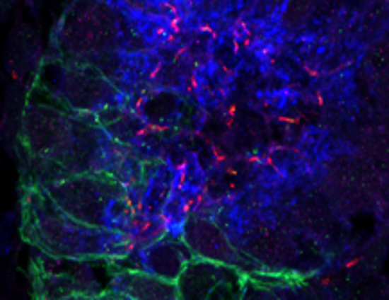 Kidney organoid_Arl13b.png